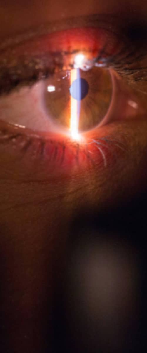 Laser treatment being performed on eye